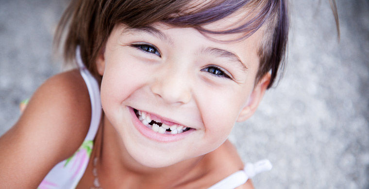 Скидка на лечение молочных зубов 15%