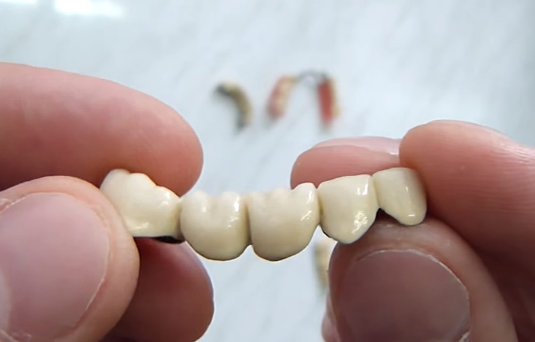 Лечение и протезирование зубов цена в Сочи