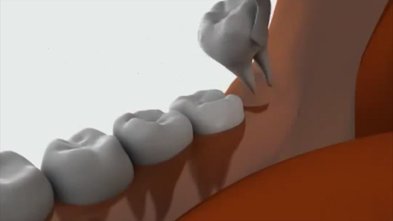 Хирургическая стоматология в Сочи стоимость