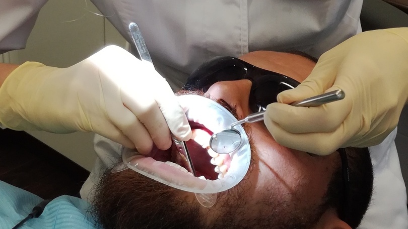 Зубные импланты в Сочи цена